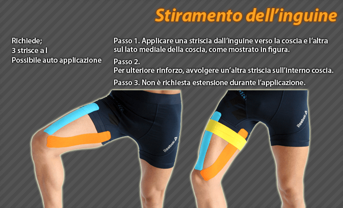stiramento dell'inguine