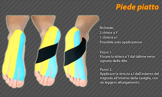 piede piatto