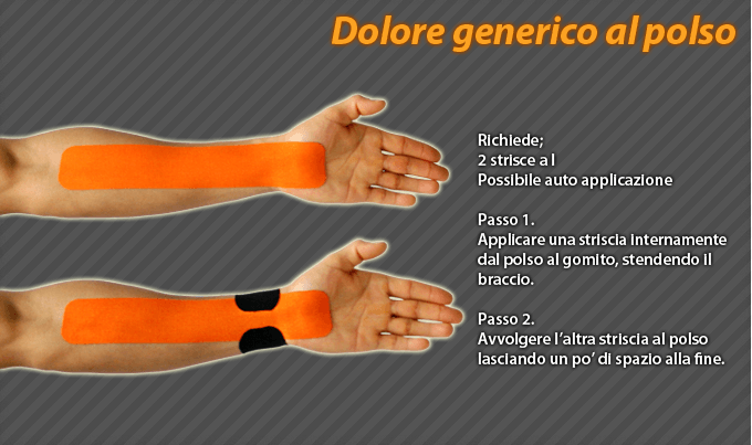 dolore generico al polso