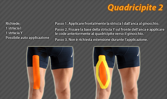 quadricipite
