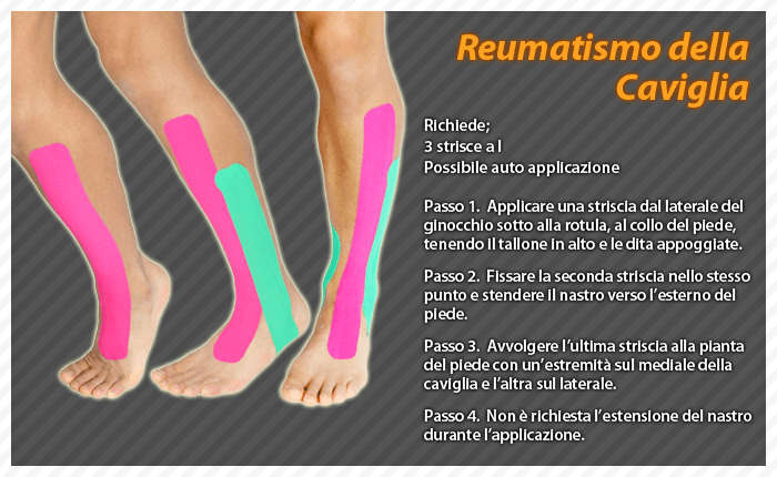 reumatismo della caviglia