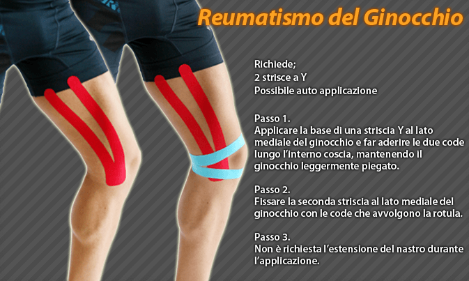 reumatismo del ginocchio