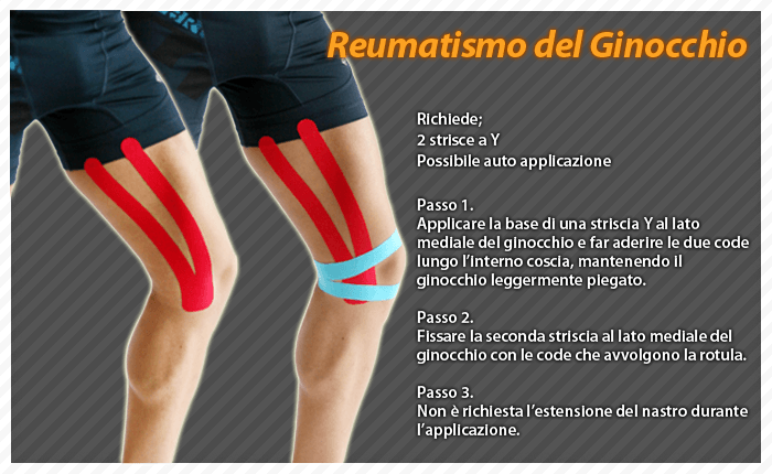 reumatismo del ginocchio