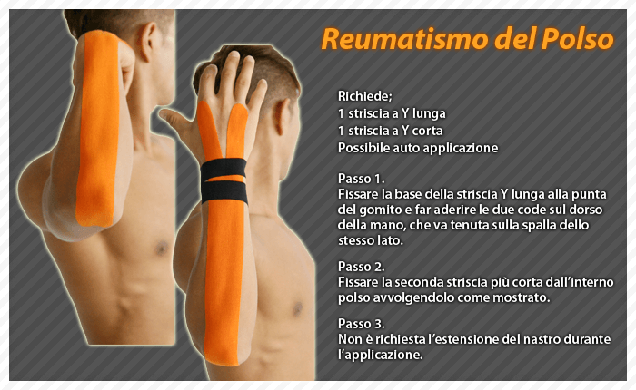 reumatismo del polso