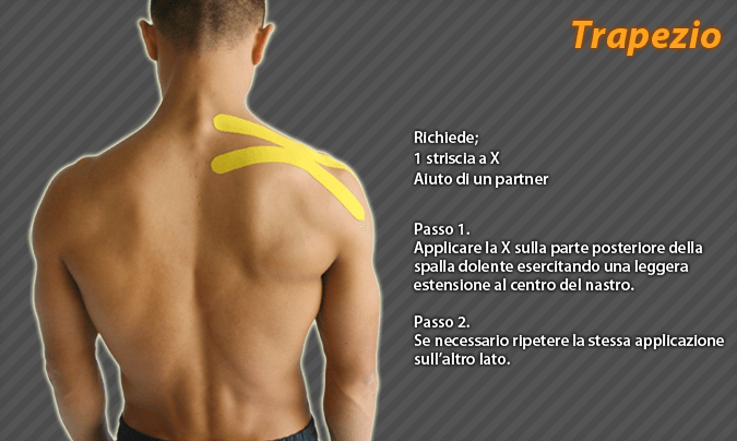 trapezio