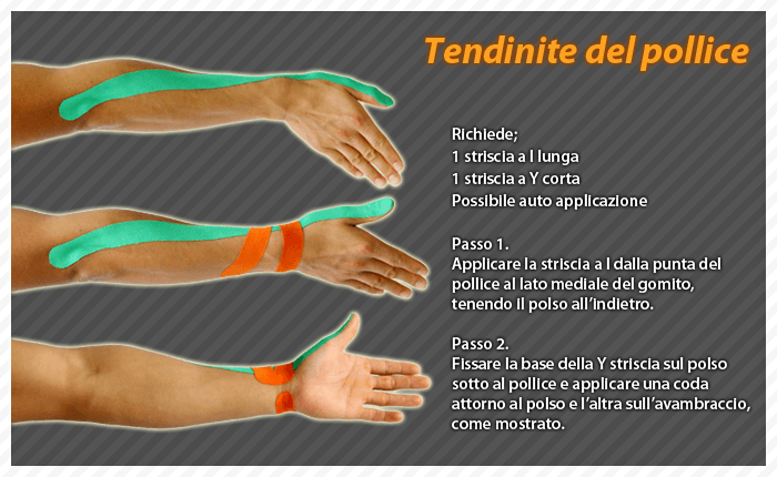 tendine del pollice
