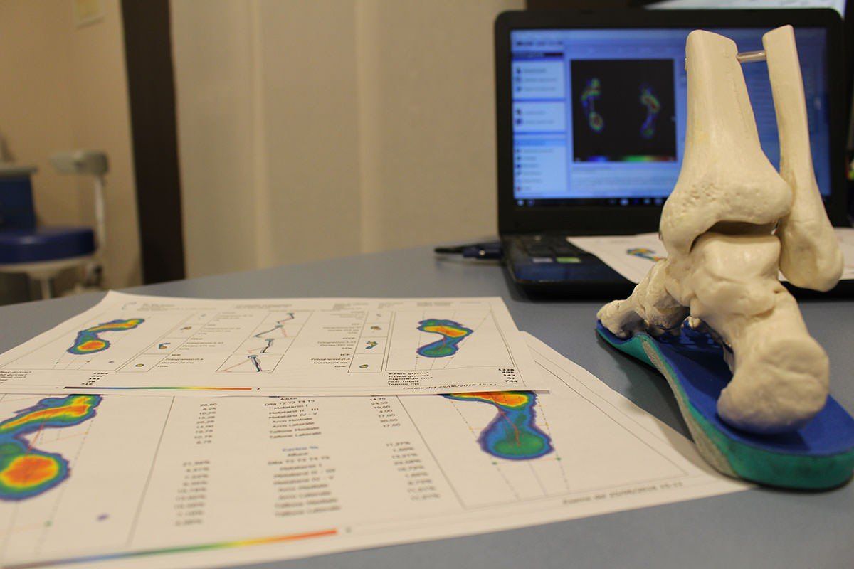 valutazione baropodometrica computerizzata