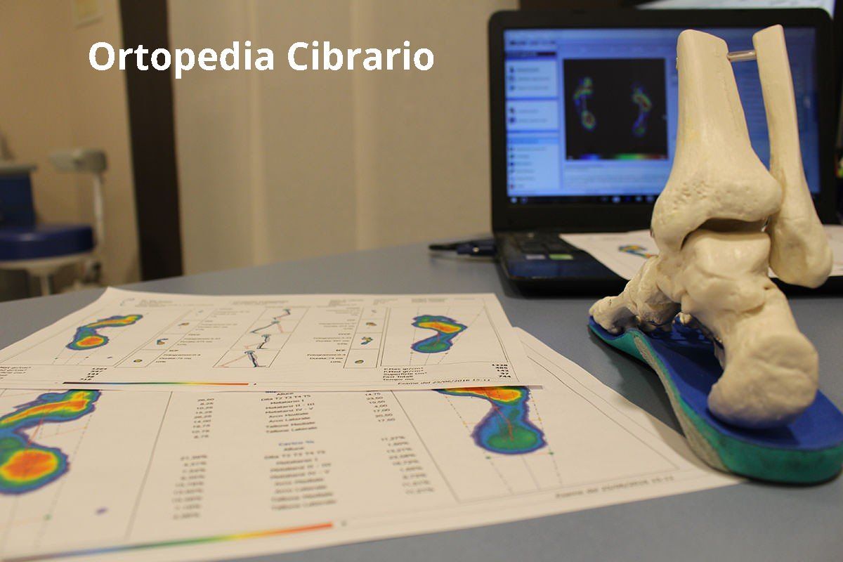 valutazione baropodometrica gratuita