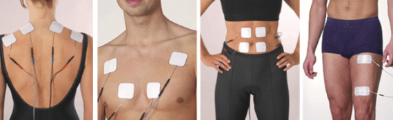 tens terapia elettrostimolazione