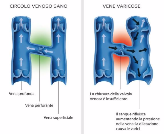 CIRCOLAZIONE calze compressive