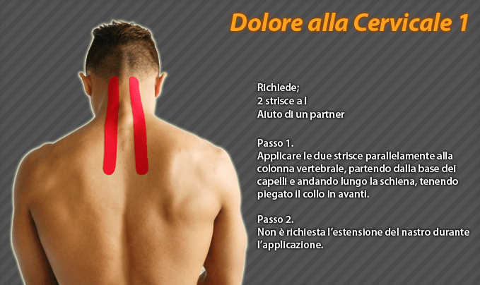 dolore alla cervicale