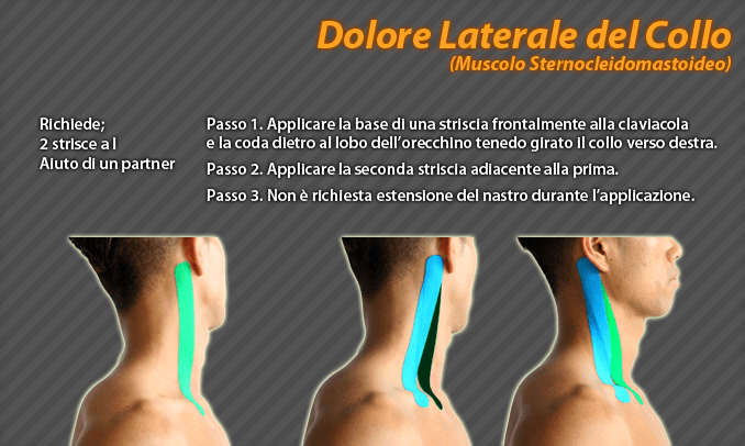 dolore laterale del collo