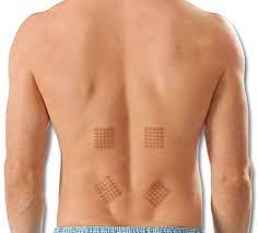 spiral tape, cross tape analgesico naturale, applicazione