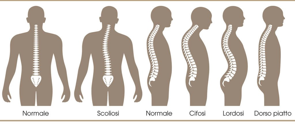 Tipologie di colonna vertebrale