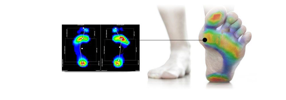 valutazione baropodometrica statica