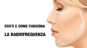 la radiofrequenza