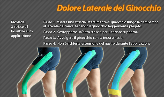 dolore laterale del ginocchio