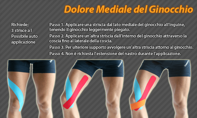 dolore mediale del ginocchio