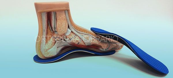 plantari su misura torino ortopedia cibrario