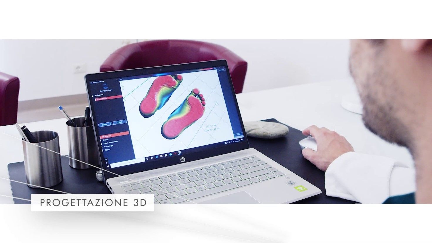 Progettazione 3D dei plantari personalizzati