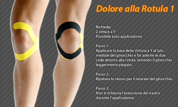 dolore alla rotula