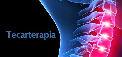 TECARTERAPIA