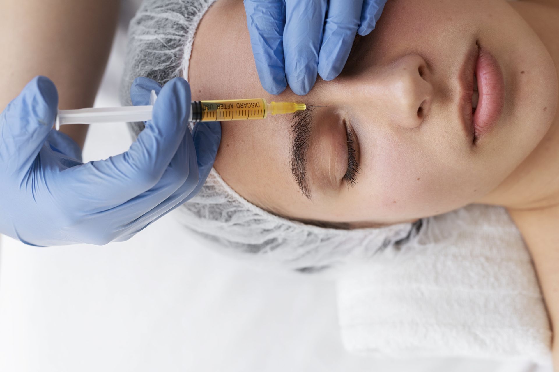Aplicaciones de Plasma rico en Plaquetas en Medicina Estética y Armonización Facial Aplicaciones de Plasma rico en Plaquetas en Medicina Estética y Armonización Facial