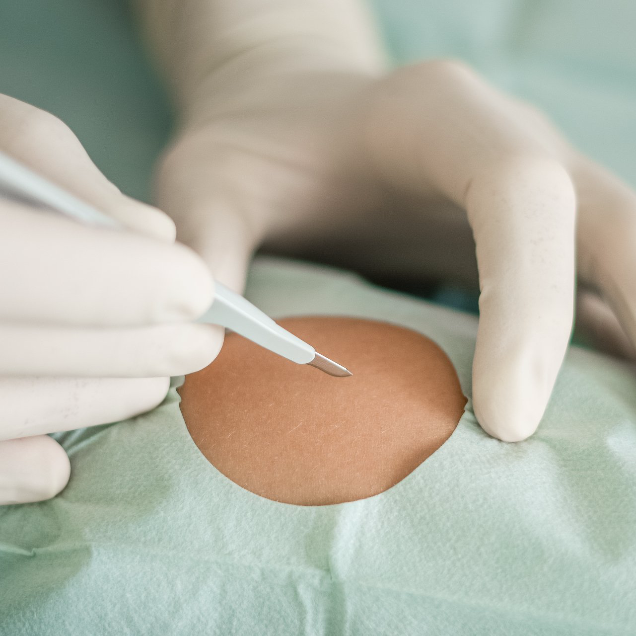 Konservative Methoden der Orthopädie