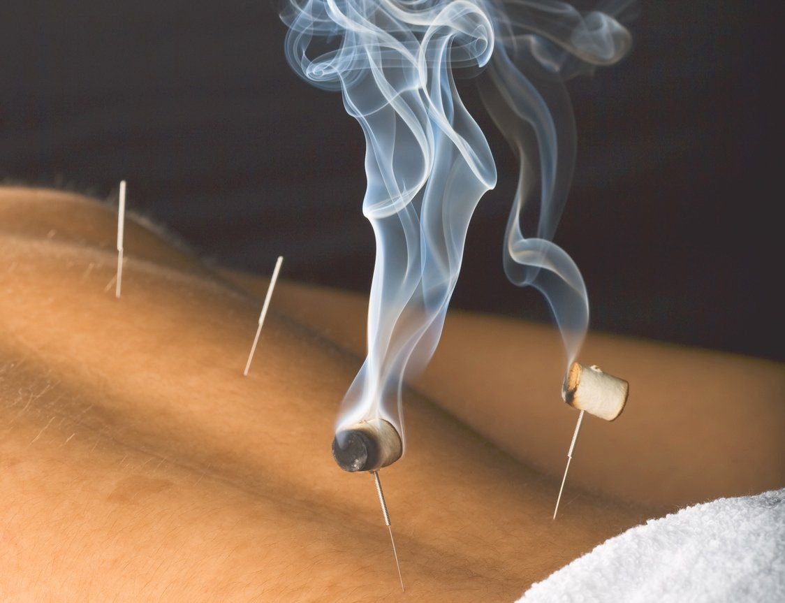 Bei der Moxatherapie werden Akupunkturpunkte erwärmt und Energie in diesen Bereich gegeben Moxa Darmstadt Beckenendlage Heilpraktiker