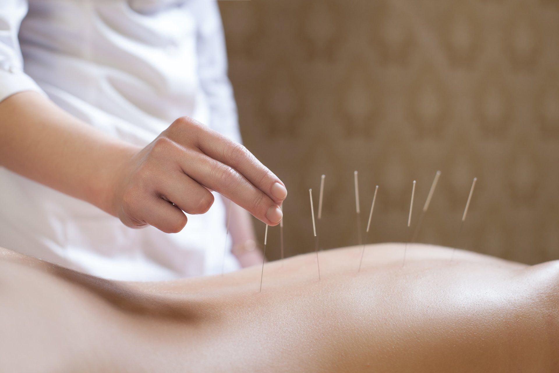Akupunktur - über die Meridiane werden unterschiedliche Beschwerden bei Kinderwunsch eingesetzt