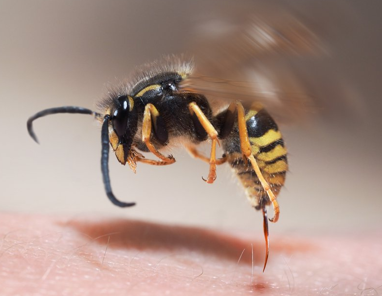 Wespenstich Wespenstich