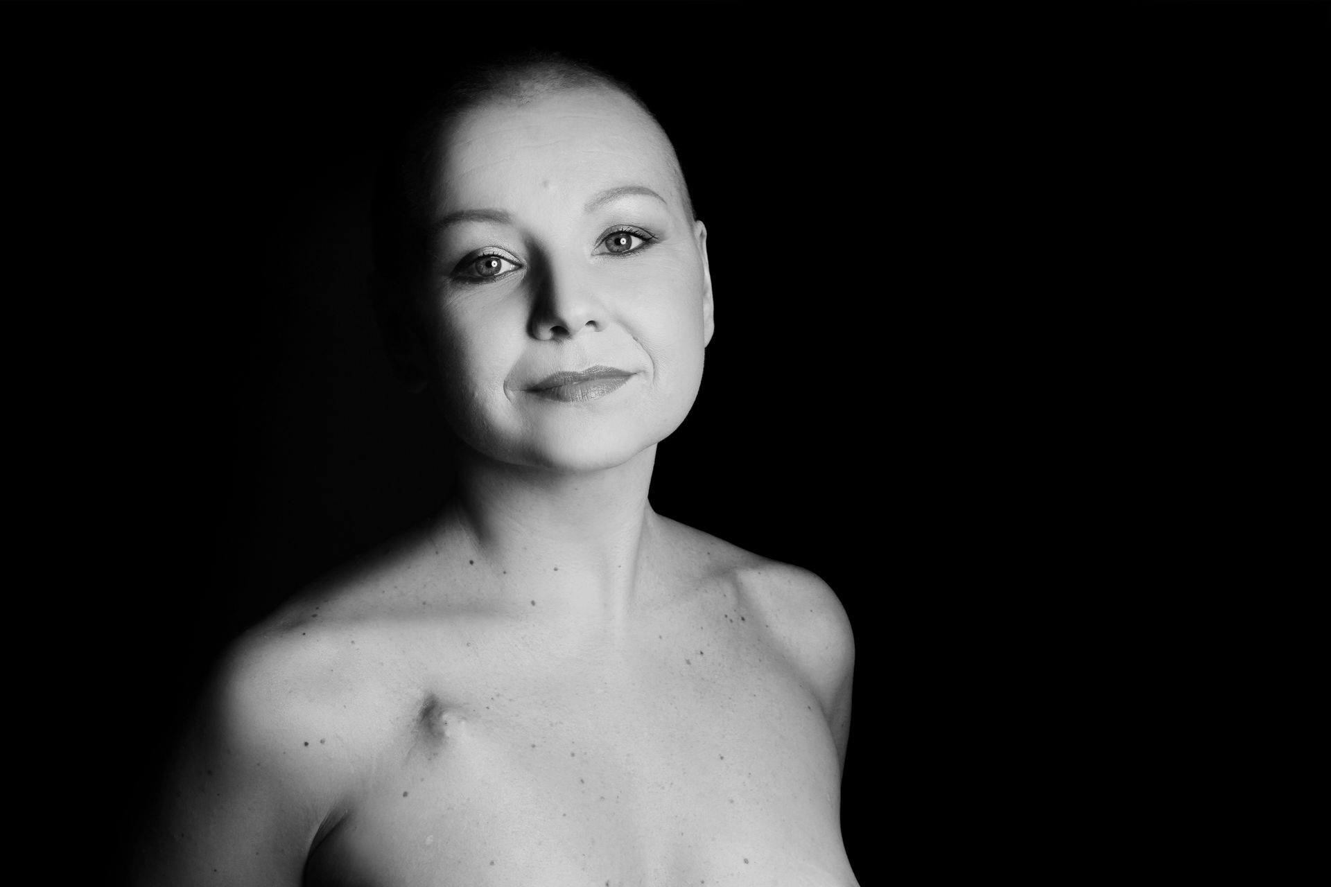 Frau nach Chemotherapie - einfühlsames Porträt beim schön & stark Fotoshooting von Franziska Günther