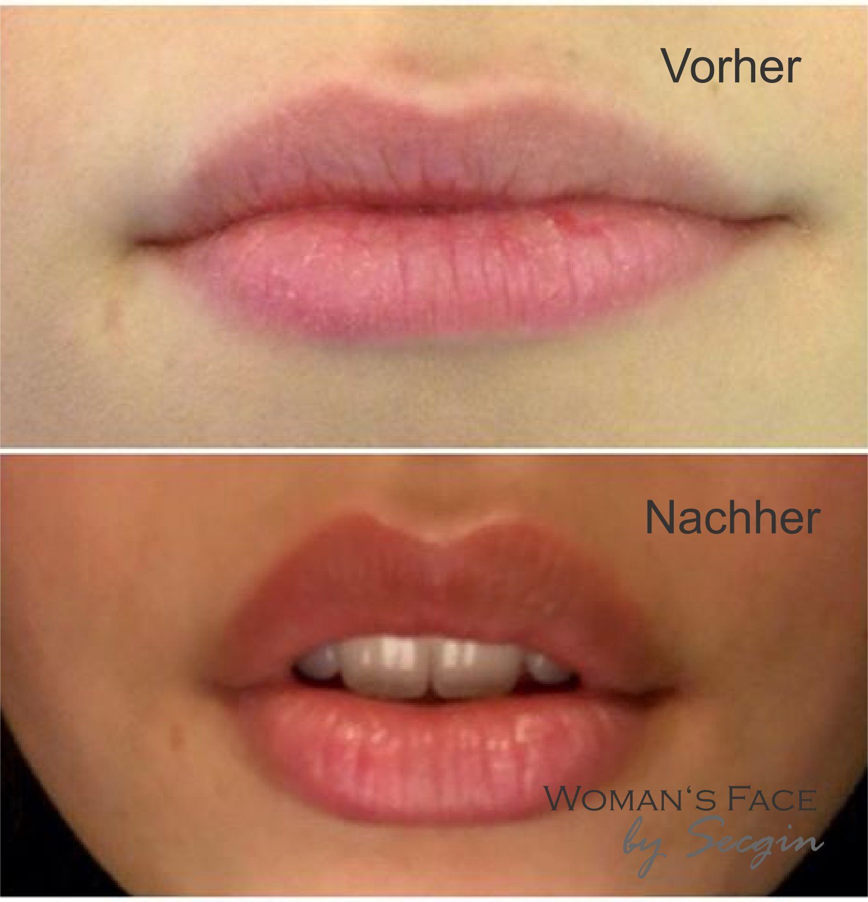 Lippenpigmentierung Permanent Make-Up