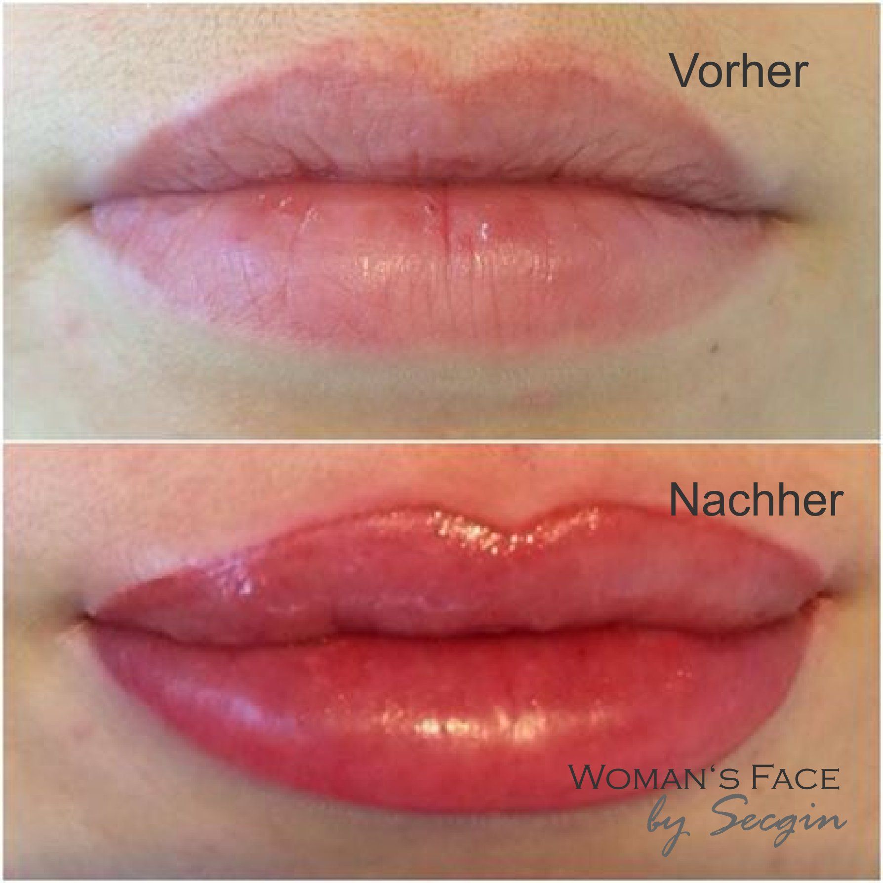 Lippenkorrektur einer Fremdarbeit Permanent Make-Up