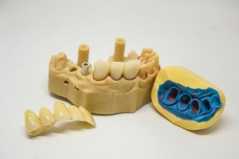 dental 3D Model
