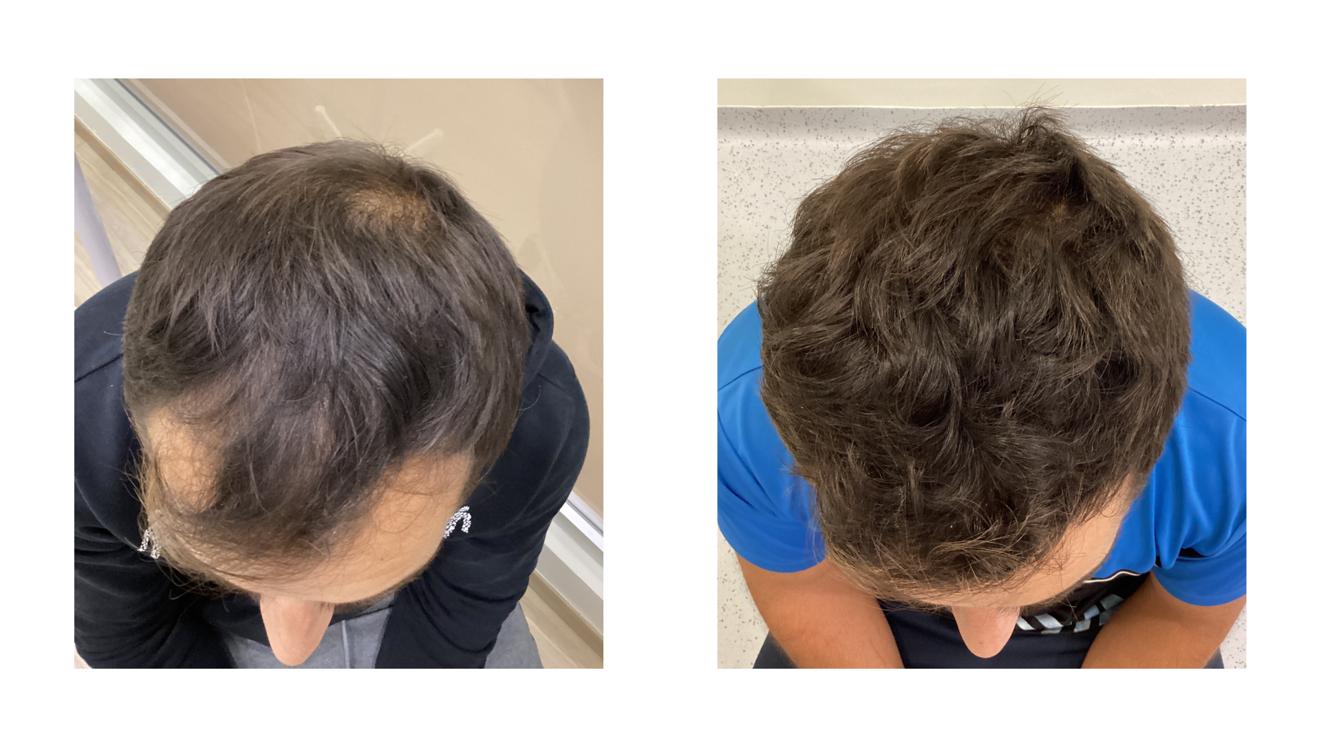 foto antes y despues