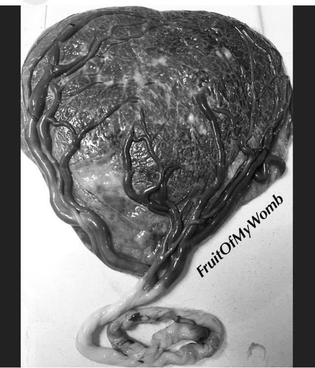 Fruit of My Womb Placenta Encapsulation Services.