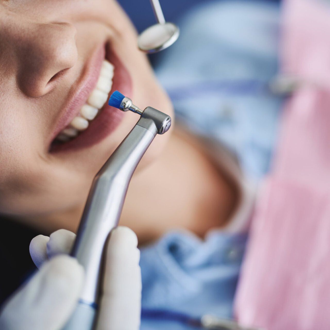 Zähne werden poliert