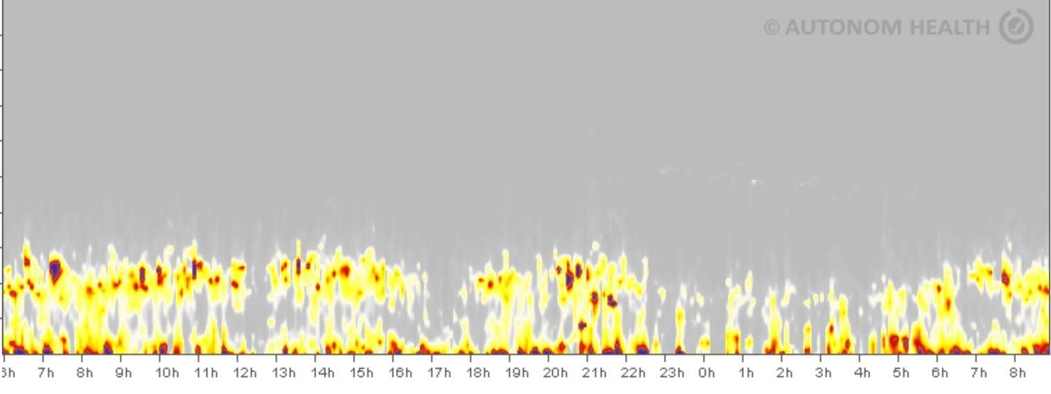 Lebensfeur-Messung im Zentrum für Gesundheitsbildung in Landshut