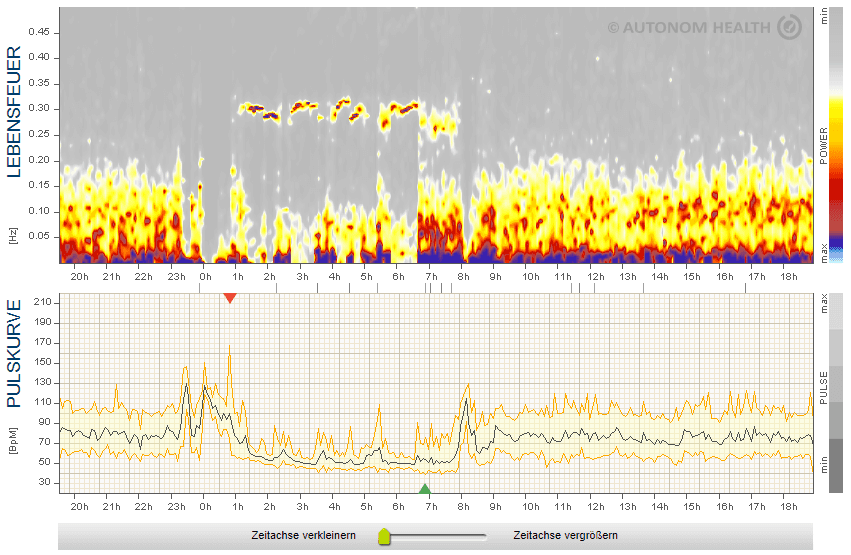 Lebensfeuer, Herzratenvariabilität, HRVr, QiGong, Vagus-Meditation, Zen-meditation, Herzkohärentes Atmen,Anti-Stressmaßnahmen im Alltag