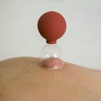 Schroepfen bei der Anwenung auf der Haut