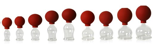 Schroepfen Schroepfglaeser Schroepfkoepfe Schroepfen Schroepfglaeser Schroepfkoepfe