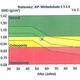 Knochendichtemessung