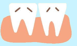Zähne Knirschen Zähne Knirschen