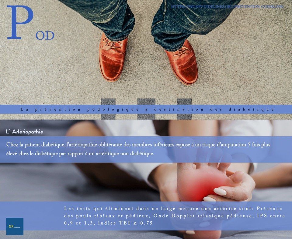 La prévention podologique à destination des diabétiques /4