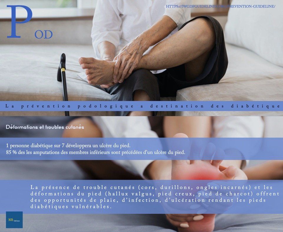 La prévention podologique à destination des diabétiques /5