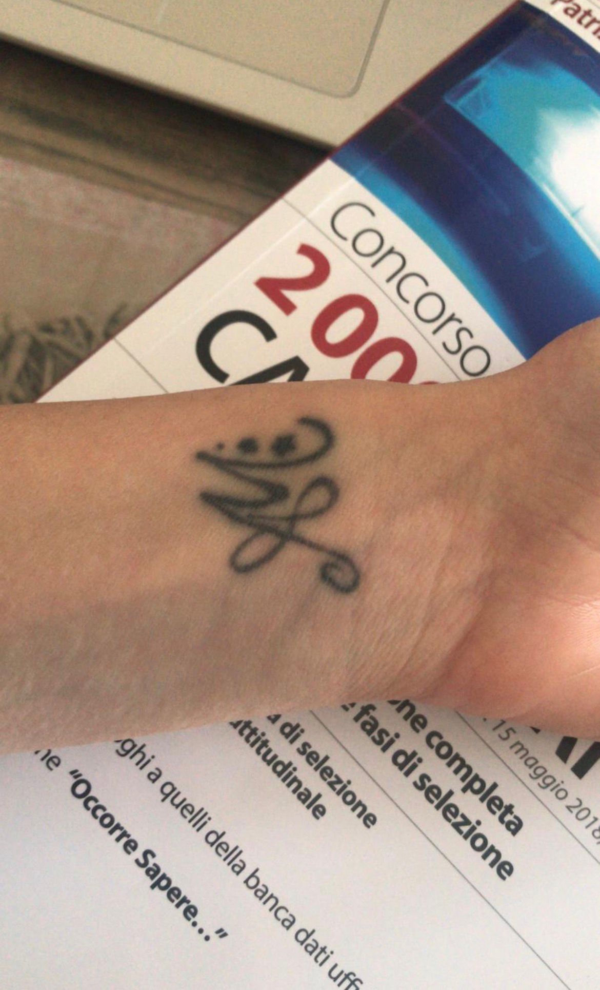 Tatuaggio prima della rimozione.