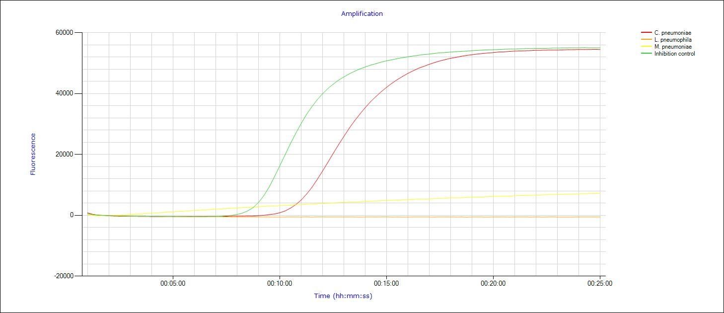 Amplifikation eazyplex Pnemocystis jirovecii Amplifikation eazyplex Pnemocystis jirovecii