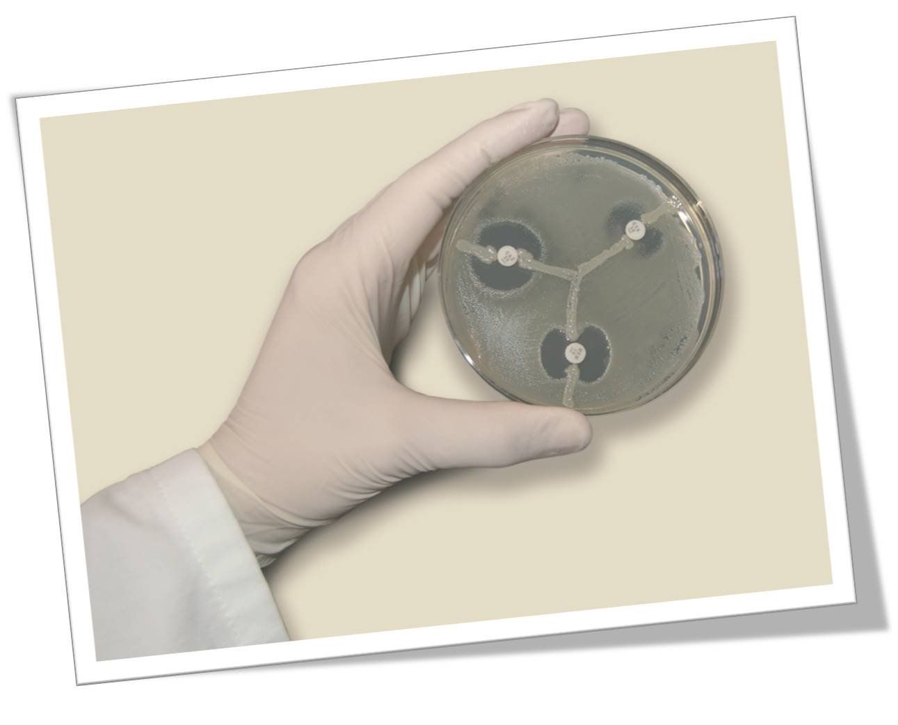 KPC oder nicht KPC? Das ist hier die Frage! KPC oder nicht KPC? Das ist hier die Frage!