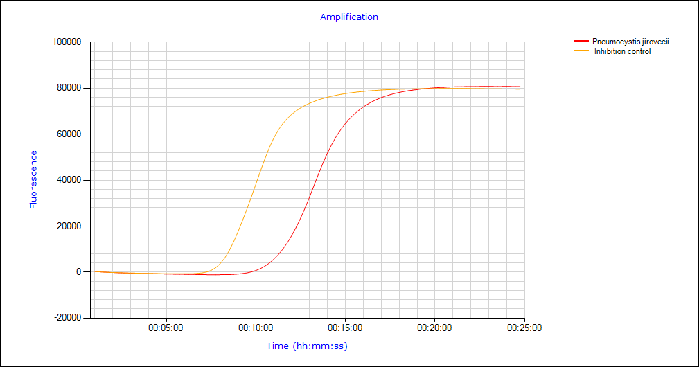 Amplifikation eazyplex Pnemocystis jirovecii Amplifikation eazyplex Pnemocystis jirovecii